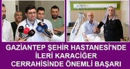 df_zRp4B.jpg